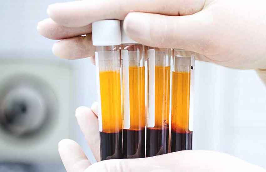 Patient receiving PRP treatment showing the minimally invasive procedure
